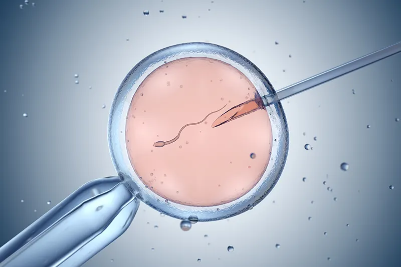 Fertilización in vitro